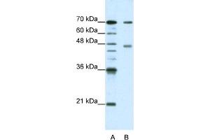 WB Suggested Anti-PABPC4 Antibody Titration:  1.