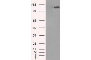 Image no. 1 for anti-L1 Cell Adhesion Molecule (L1CAM) antibody (ABIN1499083) (L1CAM anticorps)