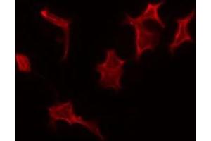 ABIN6275349 staining A549 by IF/ICC.