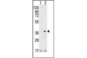 Western blot analysis of HLA-DQA1 (arrow) using HLA-DQA1 Antibody (N-term) Cat. (HLA-DQA1 anticorps  (N-Term))