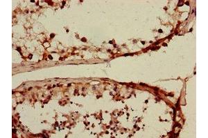 anti-Solute Carrier Family 15 Member 3 (SLC15A3) (AA 253-309) antibody