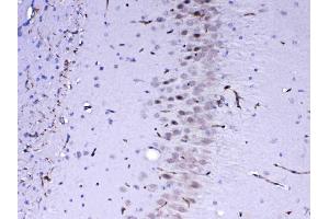 IHC analysis of MED4 using anti-MED4 antibody .