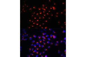 Immunofluorescence analysis of HeLa cells using SGMS1 Rabbit pAb (ABIN7270532) at dilution of 1:100.