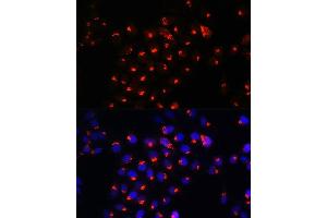 Immunofluorescence analysis of HeLa cells using SGMS1 Rabbit pAb (ABIN7270532) at dilution of 1:100. (Sphingomyelin Synthase 1 anticorps  (AA 1-134))