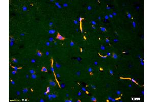 Formalin-fixed and paraffin-embedded rat brain labeled with Anti-ADAMTS7 Polyclonal Antibody, Unconjugated (ABIN672486) 1:200, overnight at 4°C, The secondary antibody was Goat Anti-Rabbit IgG, Cy3 conjugated used at 1:200 dilution for 40 minutes at 37°C.