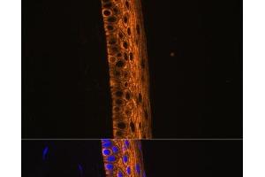 Immunofluorescence analysis of Rat eye using MYH13 Polyclonal Antibody at dilution of 1:100 (40x lens). (MYH13 anticorps)