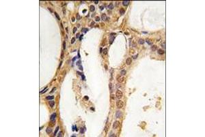 Image no. 1 for anti-Pim-1 Oncogene (PIM1) antibody (ABIN360328) (PIM1 anticorps)