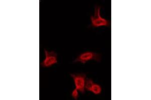 ABIN6266636 staining HuvEc by IF/ICC. (Sodium Channel-Pan anticorps)