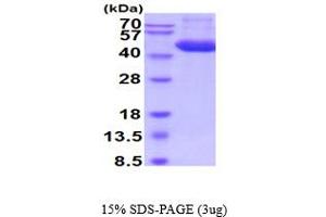 Cathepsin D (CTSD) (AA 21-410) (Active) protein (His tag)