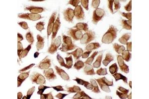 ICC testing of TRAM antibody and HeLa cells