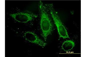 Immunofluorescence of monoclonal antibody to PAFAH1B3 on HeLa cell.