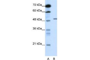 WB Suggested Anti-GABRB2 Antibody Titration:  0. (GABRB2 anticorps  (N-Term))