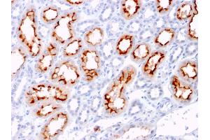 Formalin-fixed, paraffin-embedded human Renal Cell Carcinoma stained with CD137L-Monospecific Mouse Monoclonal Antibody (CD137L/1547). (TNFSF9 anticorps)