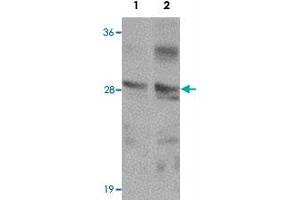 Western blot analysis of TMEM192 in SK-N-SH cell lysate with TMEM192 polyclonal antibody  at (1) 0. (TMEM192 anticorps  (C-Term))
