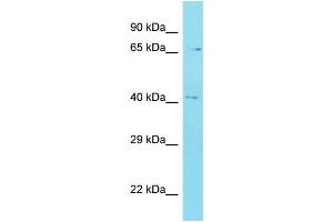 Host: Rabbit Target Name: C12orf56 Sample Type: MDA-MB-435S Whole Cell lysates Antibody Dilution: 1. (C12orf56 anticorps  (N-Term))