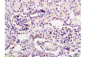 Formalin-fixed and paraffin embedded rat kidney tissue labeled with Anti CYP11A1/P450SCC Polyclonal Antibody, Unconjugated (ABIN701530) at 1:200 followed by conjugation to the secondary antibody and DAB staining.