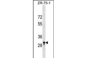 PED2 Antibody (C-term) (ABIN1536882 and ABIN2850012) western blot analysis in ZR-75-1 cell line lysates (35 μg/lane). (MPPED2 anticorps  (C-Term))