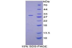SDS-PAGE analysis of Mouse Integrin alpha D Protein. (ITGAD Protéine)