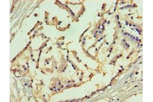 Immunohistochemistry of paraffin-embedded human prostate tissue using ABIN7158496 at dilution of 1:100 (SLC27A4 anticorps  (AA 494-643))