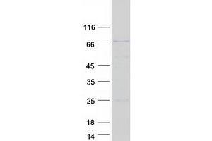 Validation with Western Blot