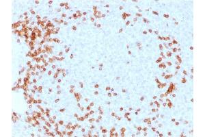 Formalin-fixed, paraffin-embedded human Spleen stained with CD3e Mouse Monoclonal Antibody (C3e/1931).