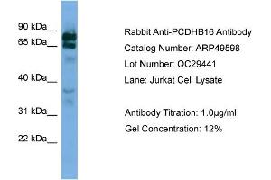 WB Suggested Anti-PCDHB16  Antibody Titration: 0. (PCDHB16 anticorps  (Middle Region))