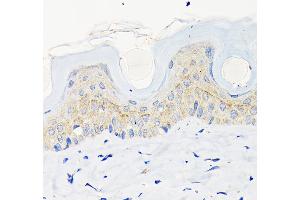 Immunohistochemistry of paraffin-embedded mouse skin using Involucrin Rabbit mAb (ABIN6128025, ABIN6141815, ABIN6141818 and ABIN7101419) at dilution of 1:100 (40x lens).