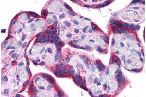 Human Placenta: Formalin-Fixed, Paraffin-Embedded (FFPE) (ATG5 anticorps  (C-Term))