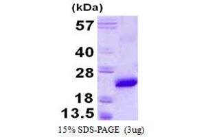 Image no. 1 for Vacuolar Protein Sorting 29 (VPS29) (AA 1-182) protein (His tag) (ABIN1098238)