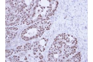 Immunohistochemical staining of paraffin-embedded NCIN87 Xenograft using TAP antibody at a dilution of 1:100 (NXF1 anticorps)