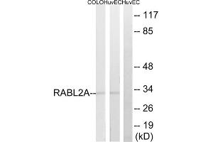 Western blot analysis of extracts from HuvEc, 293 and COLO205 cells, using RABL2A antibody. (RABL2A anticorps  (C-Term))