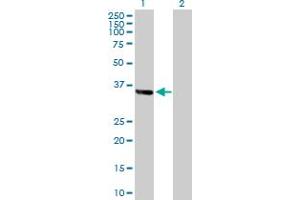 Western Blot analysis of ZNF346 expression in transfected 293T cell line by ZNF346 MaxPab polyclonal antibody. (ZNF346 anticorps  (AA 1-294))