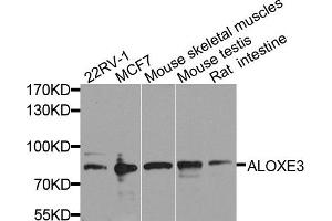 Western blot analysis of extract of various cells, using ALOXE3 antibody. (ALOXE3 anticorps)