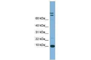 TFF1 antibody used at 1 ug/ml to detect target protein.