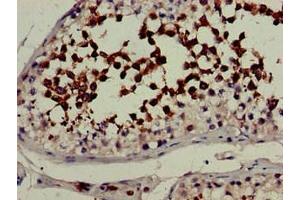 Immunohistochemistry of paraffin-embedded human testis tissue using ABIN7157910 at dilution of 1:100 (CYP51A1 anticorps  (AA 270-437))