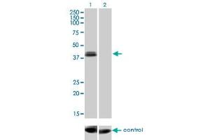 Western blot analysis of OTX1 over-expressed 293 cell line, cotransfected with OTX1 Validated Chimera RNAi (Lane 2) or non-transfected control (Lane 1). (OTX1 anticorps  (AA 10-116))