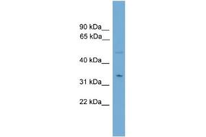 WB Suggested Anti-MGLL Antibody Titration: 0. (MGLL anticorps  (N-Term))