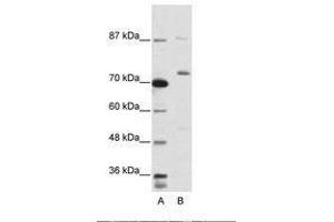 Image no. 2 for anti-Exosome Component 10 (EXOSC10) (C-Term) antibody (ABIN203030) (EXOSC10 anticorps  (C-Term))