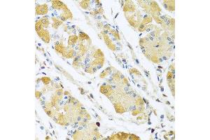 Immunohistochemistry of paraffin-embedded human stomach using C4BPB antibody at dilution of 1:100 (40x lens). (C4BPB anticorps)