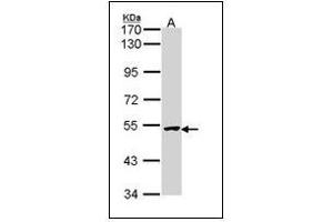 Sample (30 µg of whole cell lysate). (XIAP anticorps  (AA 75-226))