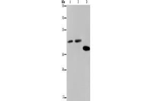 Western Blotting (WB) image for anti-serpin Peptidase Inhibitor, Clade B (Ovalbumin), Member 3 (SERPINB3) antibody (ABIN2423789) (SERPINB3 anticorps)