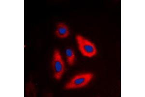 Immunofluorescent analysis of TSC2 (pT1462) staining in SHSY5Y cells. (Tuberin anticorps  (C-Term, pSer1462))