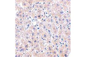 Immunohistochemistry of DRAM in human liver tissue with DRAM polyclonal antibody  at 2. (DRAM anticorps  (C-Term))