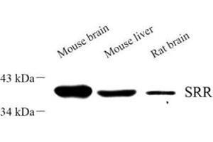 Western blot analysis of srr (ABIN7075554) at dilution of 1: 500 (SRR anticorps)
