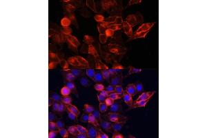 Immunofluorescence analysis of HeLa cells using CD44 antibody (ABIN6127602, ABIN6138193, ABIN6138195 and ABIN7101398) at dilution of 1:100.
