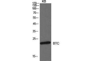 Western Blot (WB) analysis of KB cells using Probetacellulin Polyclonal Antibody. (Betacellulin anticorps  (Internal Region))