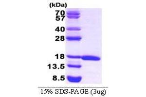 Figure annotation denotes ug of protein loaded and % gel used. (ElF5A (AA 1-154) Protéine)