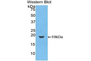 Western Blotting (WB) image for anti-CD59 (CD59) (AA 26-102) antibody (Biotin) (ABIN1174497) (CD59 anticorps  (AA 26-102) (Biotin))