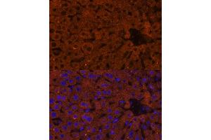 anti-3-Hydroxy-3-Methylglutaryl-CoA Synthase 2 (Mitochondrial) (HMGCS2) (AA 269-508) antibody