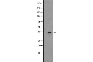 Western blot analysis of OR2T6 expression in ZR-75-1 cell line lysate ,The lane on the left is treated with the antigen-specific peptide. (OR2T6 anticorps  (C-Term))